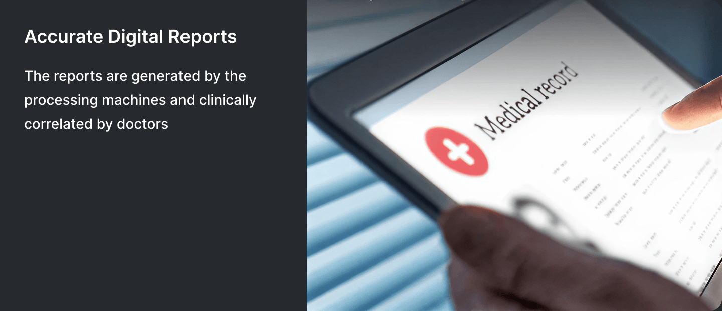Get Reports